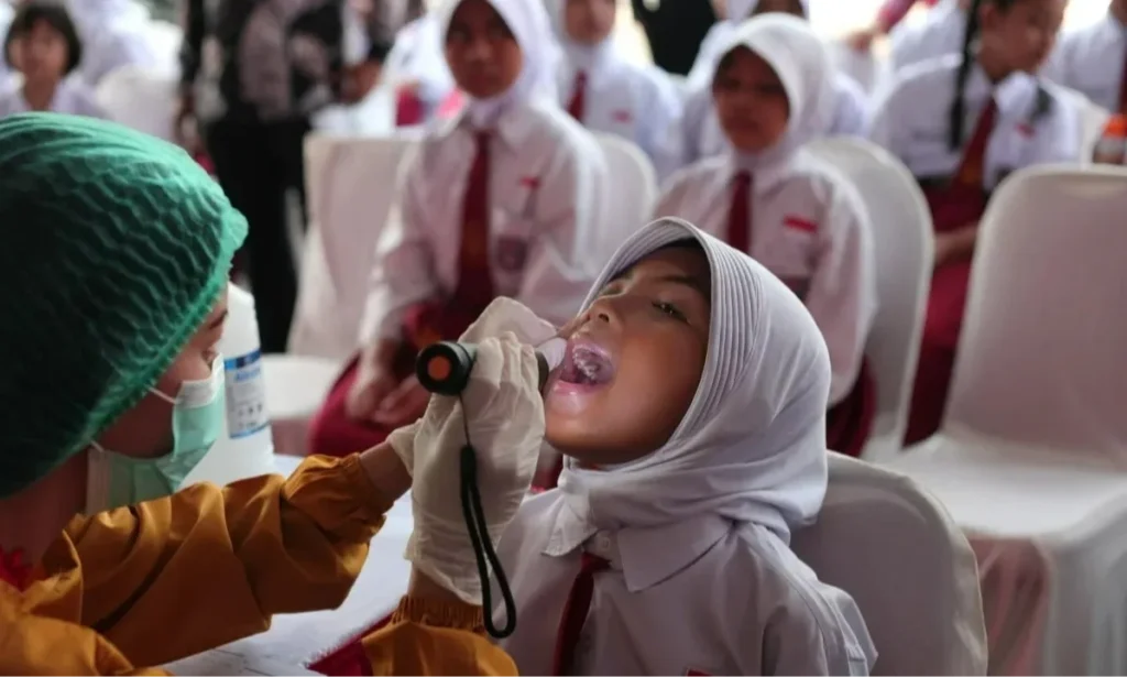 Kesehatan Berkualitas Anak Diperkuat lewat Penanganan Gigi Berlubang dalam CKG
